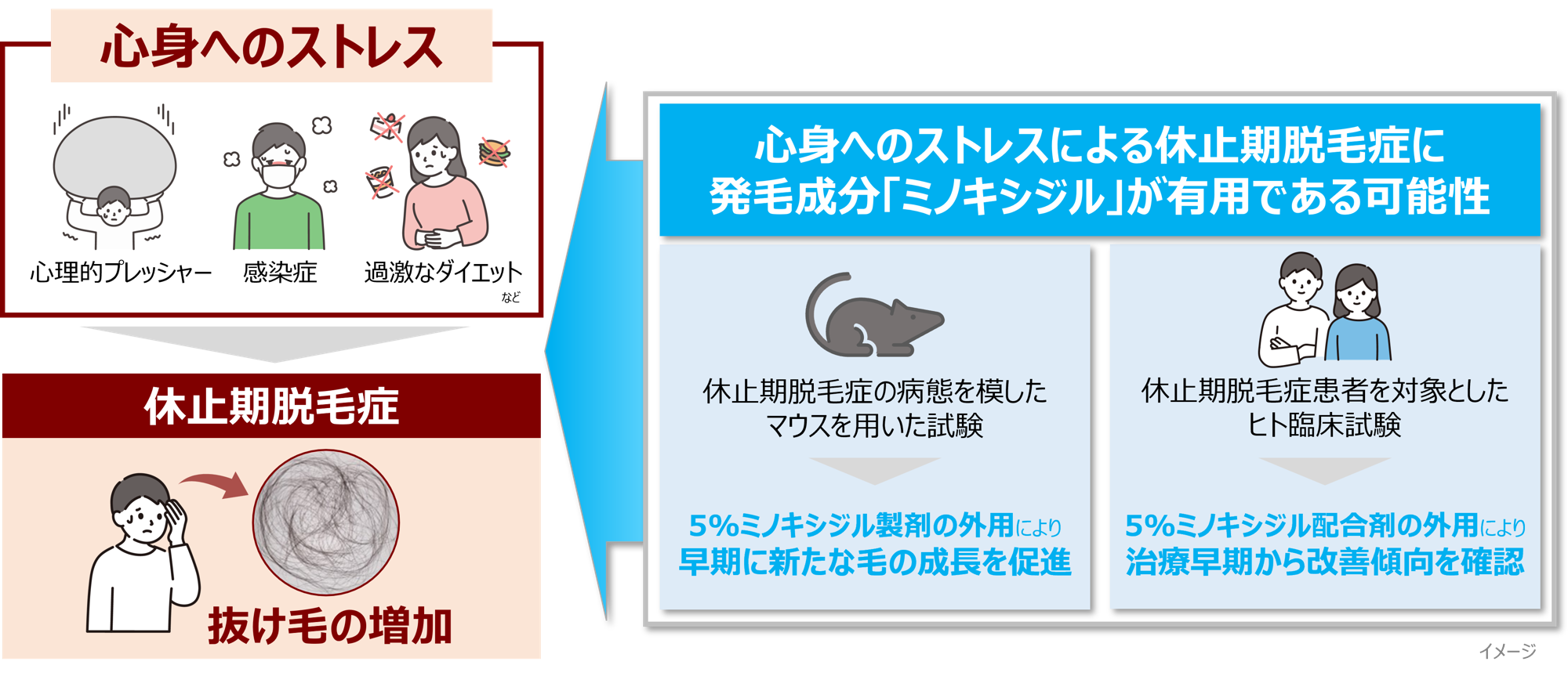 【新知見】心身へのストレスによる抜け毛の増加（休止期脱毛症）に発毛成分「ミノキシジル」が有用な可能性を見出す