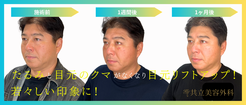 元東京ヤクルトスワローズ監督・真中満氏が共立美容外科で実感!自然なクマ取りで若々しい印象へ